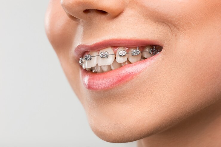 ortho-1